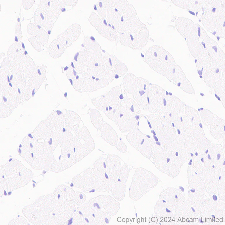 Immunohistochemistry (Formalin/PFA-fixed paraffin-embedded sections) - Anti-Cystathionase/CTH antibody [EPR29620-93] (AB323266)