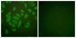 Immunocytochemistry/ Immunofluorescence - Anti-Cystatin A antibody (AB166805)