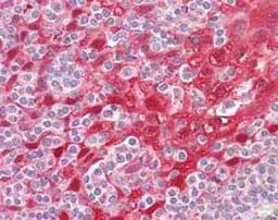 Immunohistochemistry (Formalin/PFA-fixed paraffin-embedded sections) - Anti-Cystatin A antibody (AB166805)