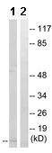 Western blot - Anti-Cystatin A antibody (AB166805)