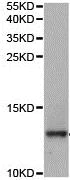 Western blot - Anti-Cystatin A antibody (AB188502)