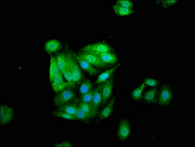 Immunocytochemistry/ Immunofluorescence - Anti-Cystatin-B antibody (ab236646), expandable thumbnail