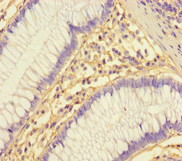 Immunohistochemistry (Formalin/PFA-fixed paraffin-embedded sections) - Anti-Cystatin-B antibody (AB236646), expandable thumbnail