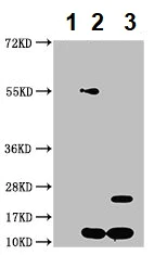 Immunoprecipitation - Anti-Cystatin-B antibody (AB236646)