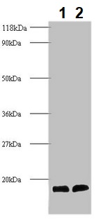 Western blot - Anti-Cystatin-B antibody (AB236646), expandable thumbnail