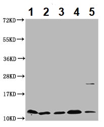 Western blot - Anti-Cystatin-B antibody (AB236646), expandable thumbnail