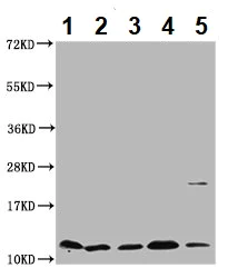 Western blot - Anti-Cystatin-B antibody (AB236646)