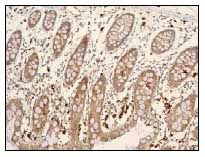 Immunohistochemistry (Formalin/PFA-fixed paraffin-embedded sections) - Anti-Cystatin-B antibody [EPR3931] (AB92449)