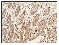 Immunohistochemistry (Formalin/PFA-fixed paraffin-embedded sections) - Anti-Cystatin-B antibody [EPR3931] - BSA and Azide free (AB247554)