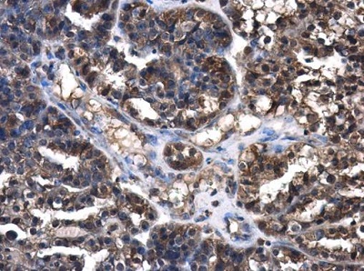 Immunohistochemistry (Formalin/PFA-fixed paraffin-embedded sections) - Anti-Cystatin C antibody (AB226841), expandable thumbnail