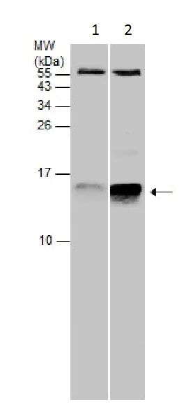 Western blot - Anti-Cystatin C antibody (AB226841)