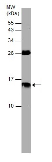 Western blot - Anti-Cystatin C antibody (AB226841), expandable thumbnail