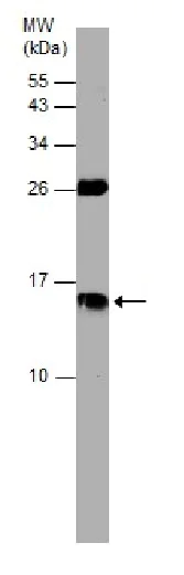 Western blot - Anti-Cystatin C antibody (AB226841)