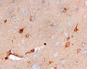 Immunohistochemistry (Formalin/PFA-fixed paraffin-embedded sections) - Anti-Cystatin C antibody [EPR4413] (AB109508), expandable thumbnail