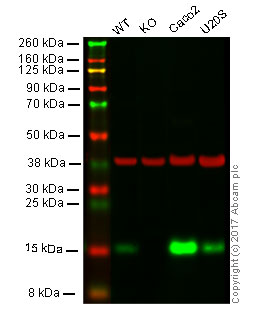 Western blot - Anti-Cystatin C antibody [EPR4413] (AB109508), expandable thumbnail