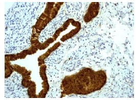 Immunohistochemistry (Formalin/PFA-fixed paraffin-embedded sections) - Anti-Cystatin C antibody [EPR4502] - BSA and Azide free (AB248523), expandable thumbnail