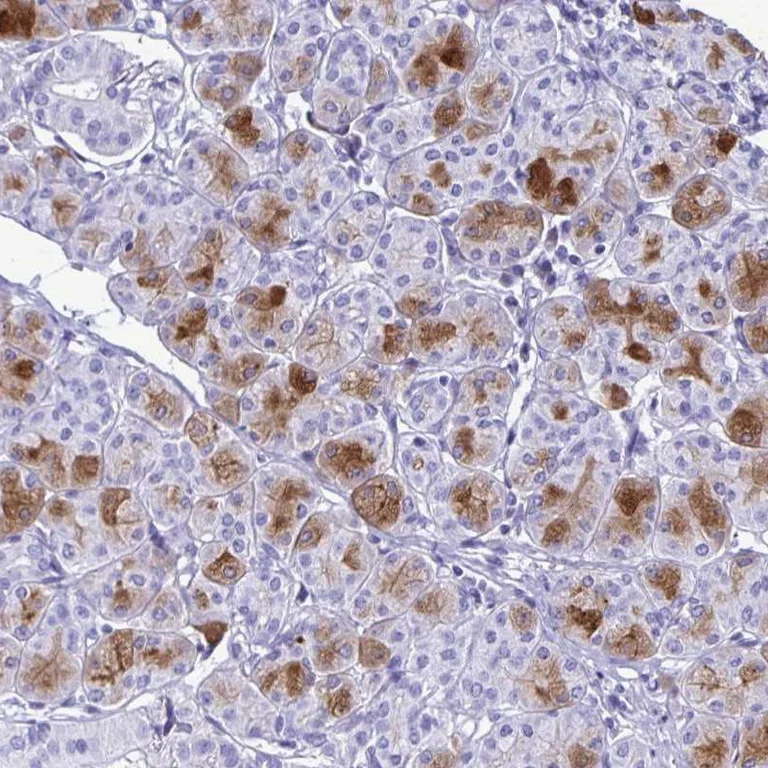 Immunohistochemistry (Formalin/PFA-fixed paraffin-embedded sections) - Anti-Cystatin D antibody (AB254963)