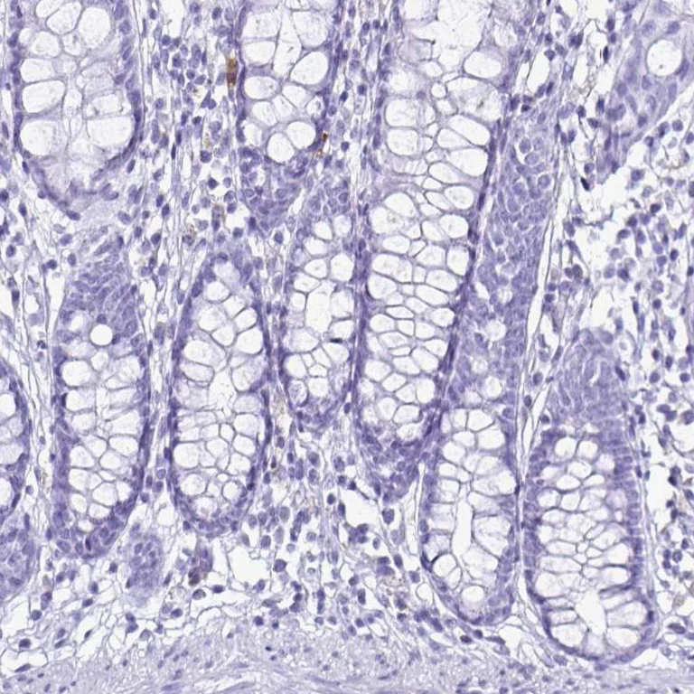 Immunohistochemistry (Formalin/PFA-fixed paraffin-embedded sections) - Anti-Cystatin D antibody (AB254963)
