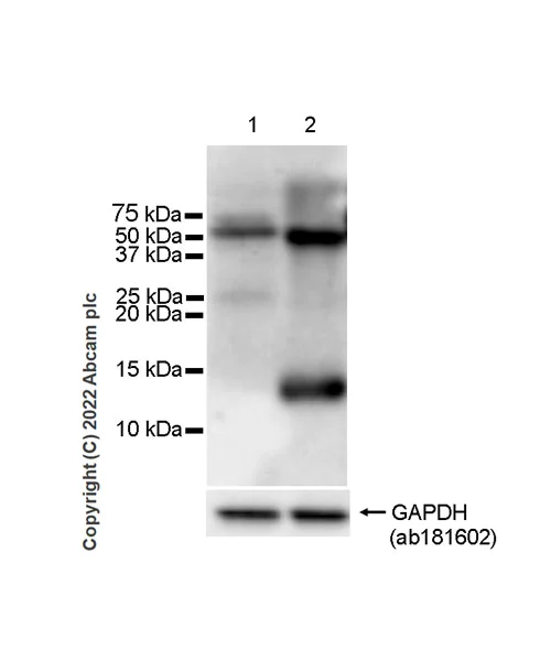 Western blot - Anti-Cystatin D antibody [EPR25935-47] (AB305062)