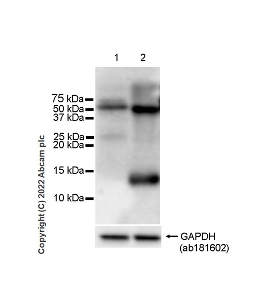 Western blot - Anti-Cystatin D antibody [EPR25935-47] - BSA and Azide free (AB305063)