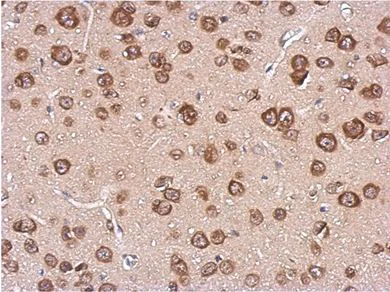 Immunohistochemistry (Formalin/PFA-fixed paraffin-embedded sections) - Anti-Cystatin F antibody (AB152152)