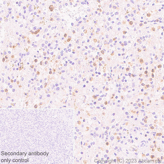 Immunohistochemistry (Formalin/PFA-fixed paraffin-embedded sections) - Anti-Cystatin F antibody [EPR28408-30] (AB309544), expandable thumbnail