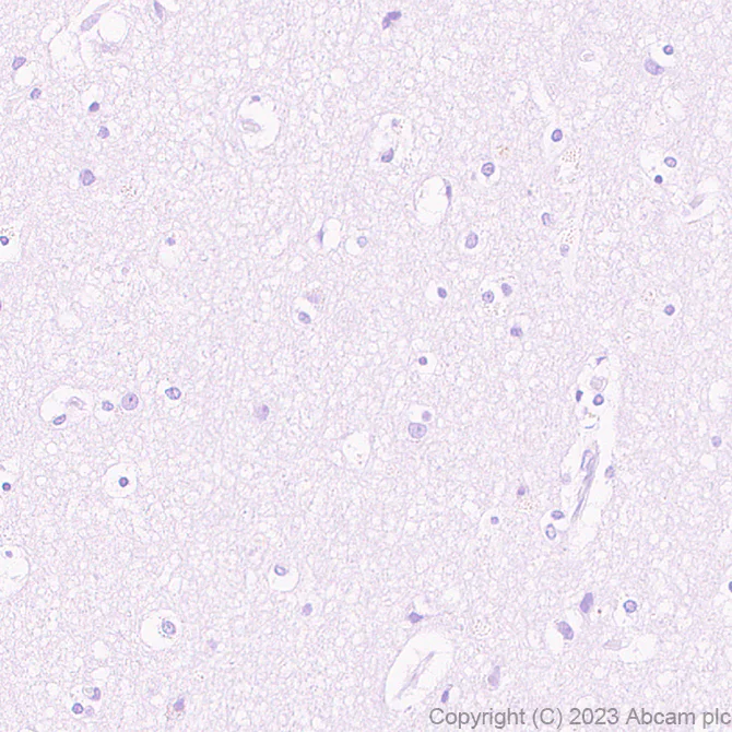 Immunohistochemistry (Formalin/PFA-fixed paraffin-embedded sections) - Anti-Cystatin F antibody [EPR28408-30] (AB309544)