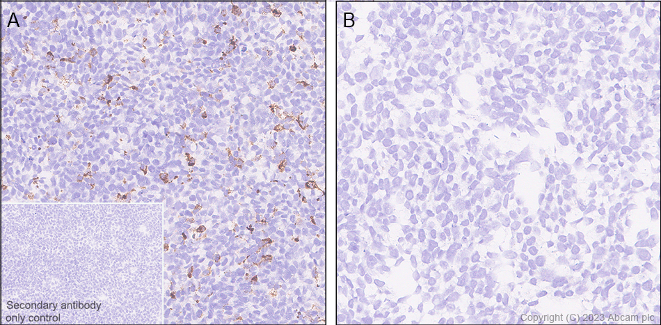 Immunohistochemistry (Formalin/PFA-fixed paraffin-embedded sections) - Anti-Cystatin F antibody [EPR28408-30] (AB309544), expandable thumbnail