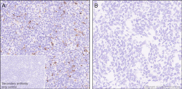 Immunohistochemistry (Formalin/PFA-fixed paraffin-embedded sections) - Anti-Cystatin F antibody [EPR28408-30] (AB309544)