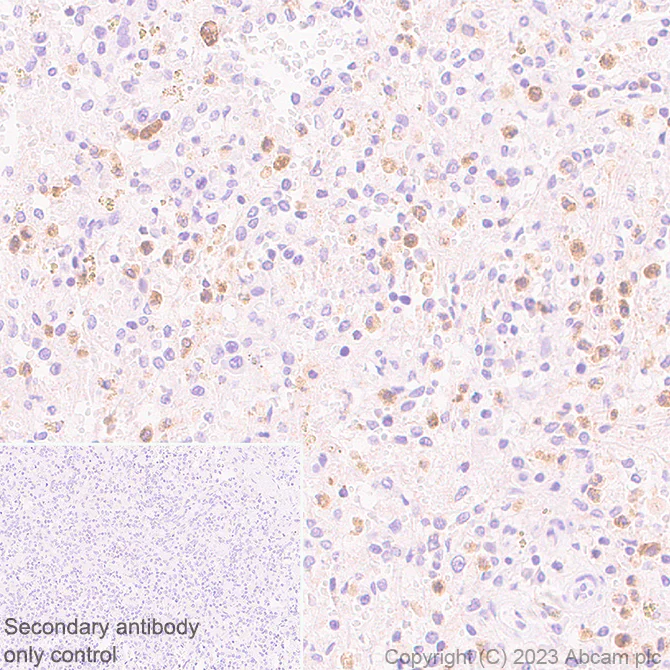 Immunohistochemistry (Formalin/PFA-fixed paraffin-embedded sections) - Anti-Cystatin F antibody [EPR28408-30] - BSA and Azide free (AB309545)