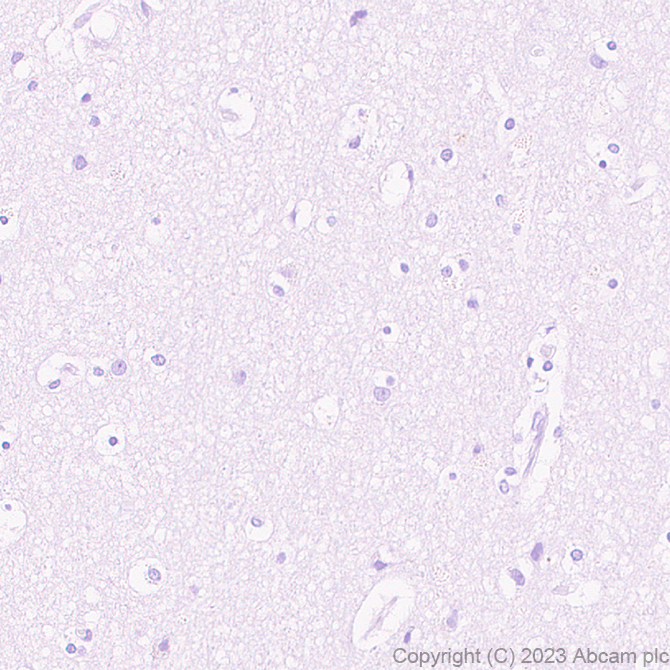 Immunohistochemistry (Formalin/PFA-fixed paraffin-embedded sections) - Anti-Cystatin F antibody [EPR28408-30] - BSA and Azide free (AB309545)