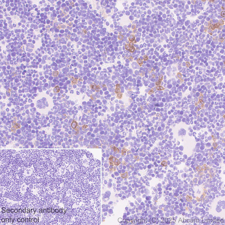 Immunohistochemistry (Formalin/PFA-fixed paraffin-embedded sections) - Anti-Cystatin F antibody [EPR29573-88] (AB325174)