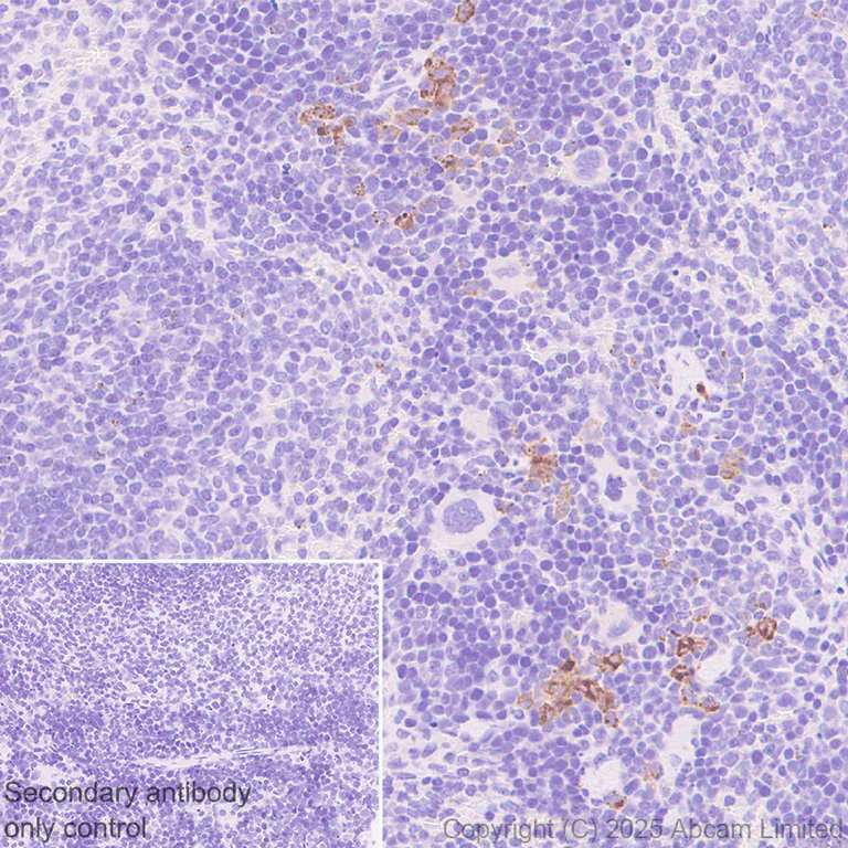 Immunohistochemistry (Formalin/PFA-fixed paraffin-embedded sections) - Anti-Cystatin F antibody [EPR29573-88] (AB325174)