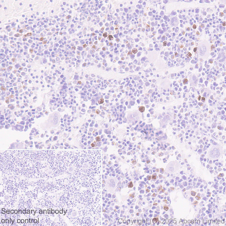 Immunohistochemistry (Formalin/PFA-fixed paraffin-embedded sections) - Anti-Cystatin F antibody [EPR29573-88] (AB325174)
