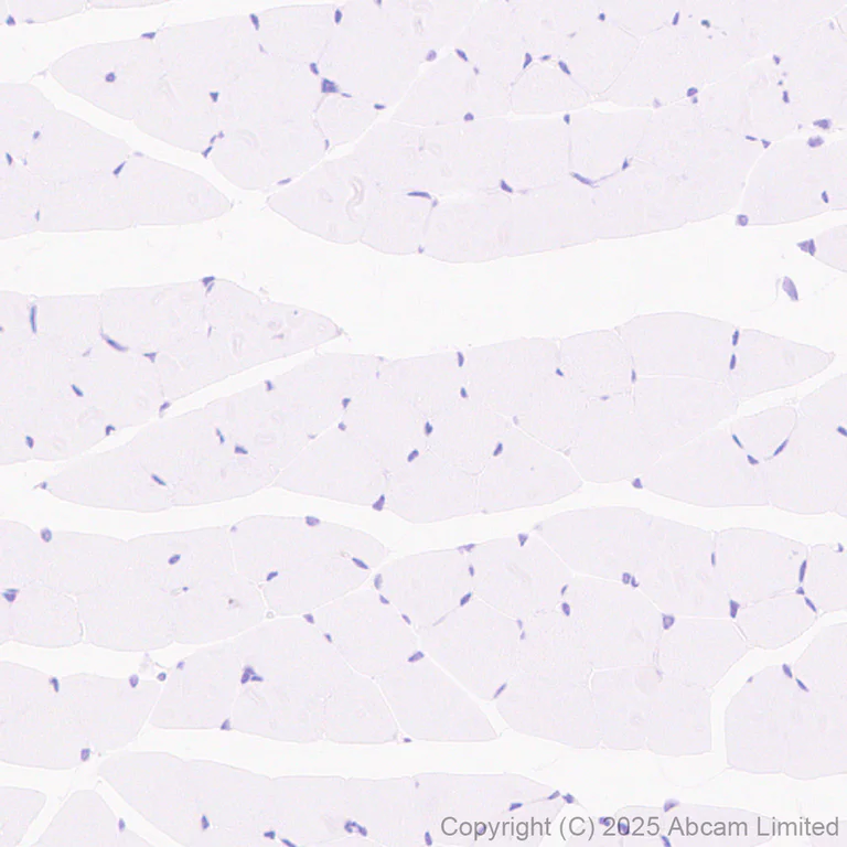 Immunohistochemistry (Formalin/PFA-fixed paraffin-embedded sections) - Anti-Cystatin F antibody [EPR29573-88] (AB325174)