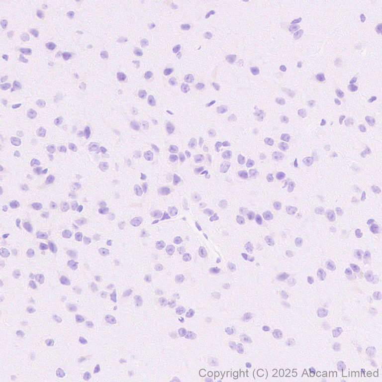 Immunohistochemistry (Formalin/PFA-fixed paraffin-embedded sections) - Anti-Cystatin F antibody [EPR29573-88] (AB325174)