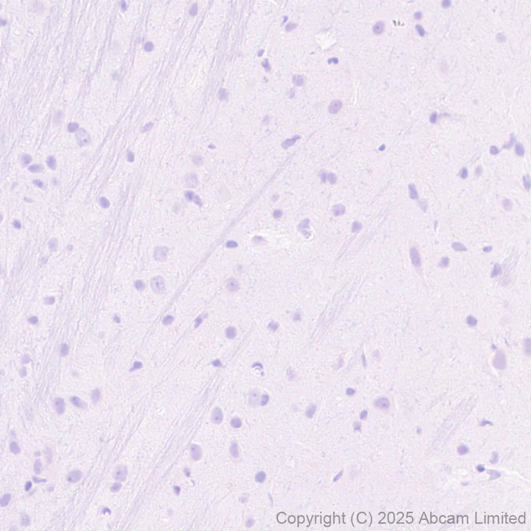 Immunohistochemistry (Formalin/PFA-fixed paraffin-embedded sections) - Anti-Cystatin F antibody [EPR29573-88] (AB325174)