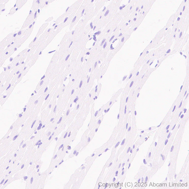 Immunohistochemistry (Formalin/PFA-fixed paraffin-embedded sections) - Anti-Cystatin F antibody [EPR29573-88] (AB325174)