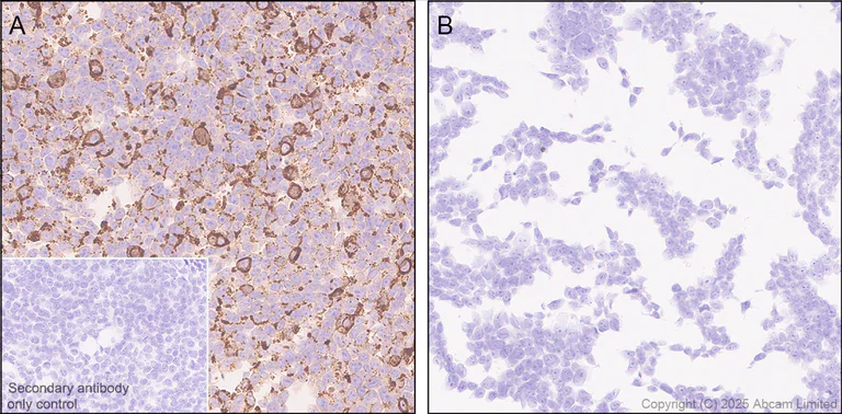 Immunohistochemistry (Formalin/PFA-fixed paraffin-embedded sections) - Anti-Cystatin F antibody [EPR29573-88] (AB325174)