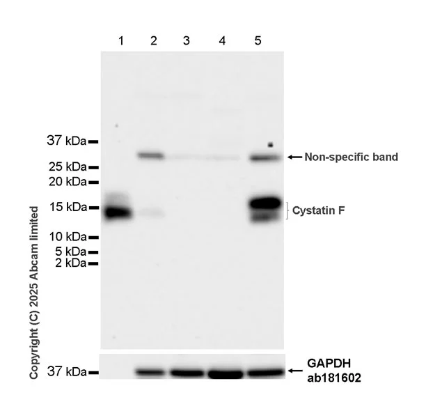Western blot - Anti-Cystatin F antibody [EPR29573-88] (AB325174)