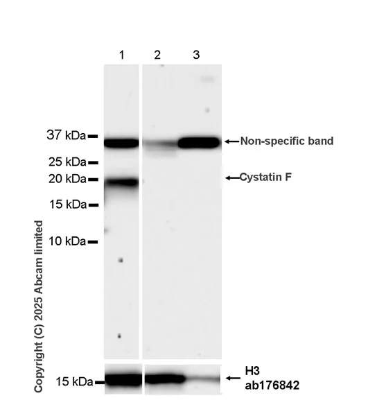 Western blot - Anti-Cystatin F antibody [EPR29573-88] (AB325174)