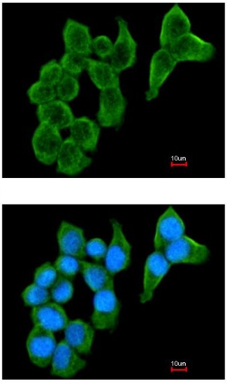 Immunocytochemistry/ Immunofluorescence - Anti-Cystatin S antibody (AB151771)
