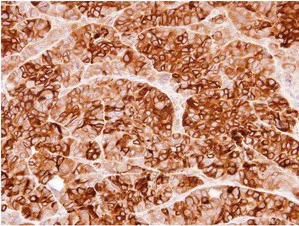 Immunohistochemistry (Formalin/PFA-fixed paraffin-embedded sections) - Anti-Cystatin S antibody (AB151771)