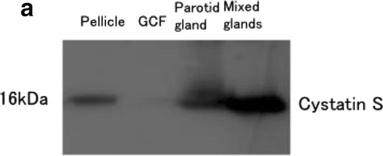 Western blot - Anti-Cystatin S antibody (AB151771)