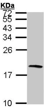 Western blot - Anti-Cystatin S antibody (AB151771)