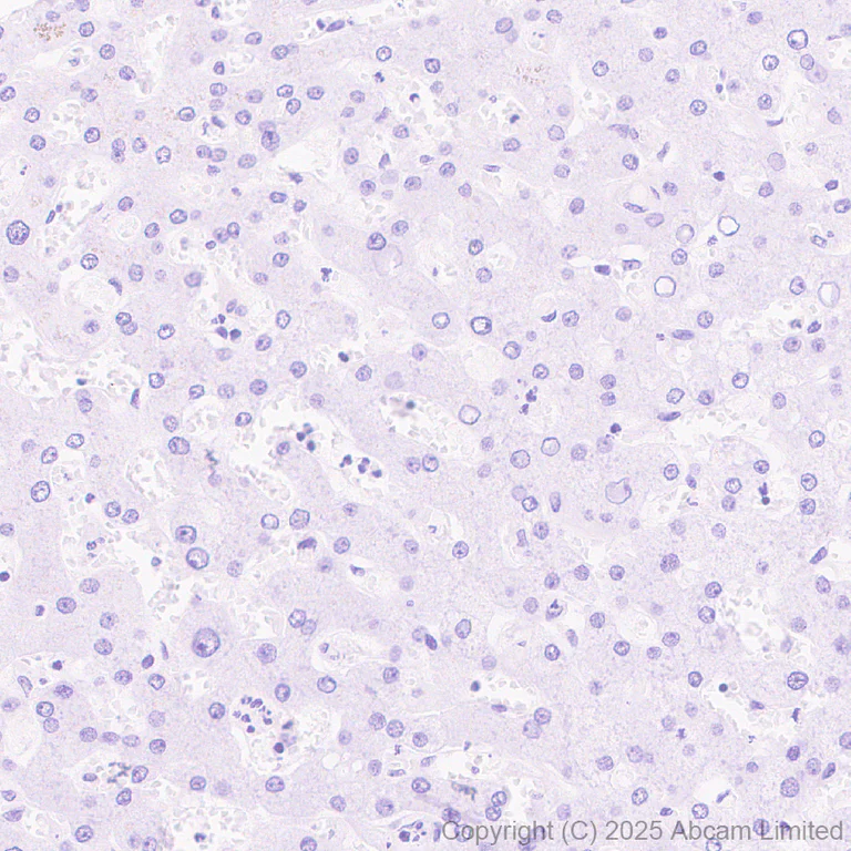 Immunohistochemistry (Formalin/PFA-fixed paraffin-embedded sections) - Anti-Cystatin SA/CST2 antibody [EPR25934-14] (AB325126)