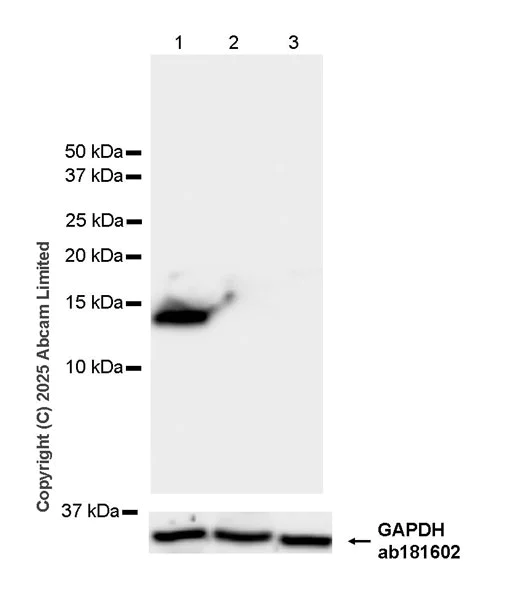 Western blot - Anti-Cystatin SA/CST2 antibody [EPR25934-14] (AB325126)