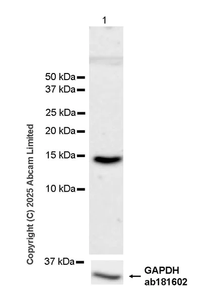 Western blot - Anti-Cystatin SA/CST2 antibody [EPR25934-14] (AB325126)
