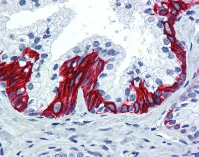 Immunohistochemistry (Formalin/PFA-fixed paraffin-embedded sections) - Anti-Cystatin SN/CST1 antibody (AB124281)