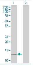 Western blot - Anti-Cystatin SN/CST1 antibody (AB68329)